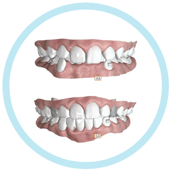 MasterCOIP-teeth-images MasterCOIP-teeth-images